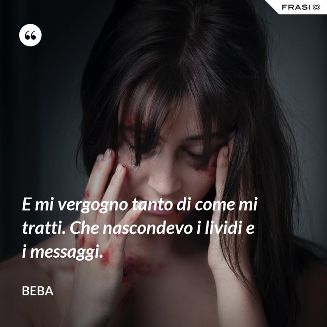 E mi vergogno tanto di come mi tratti. Che nascondevo i lividi e i messaggi. - Beba