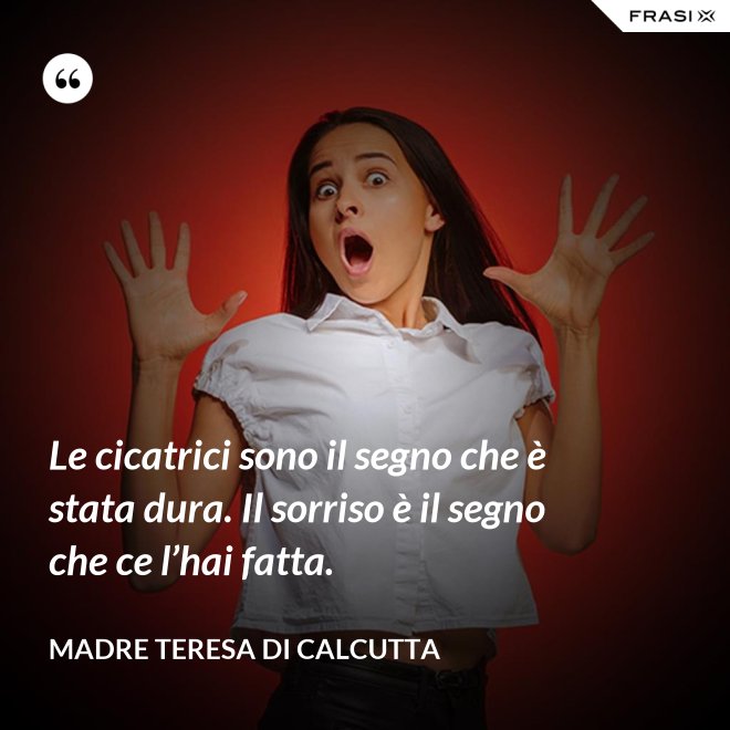 Le cicatrici sono il segno che è stata dura. Il sorriso è il segno che ce l’hai fatta. - Madre Teresa Di Calcutta
